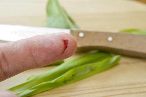 Kleine Hautverletzung als Risiko für eine Sepsis Ein Zeigefinger mit einer kleinen blutenden Scnittwunde. Im Hintergrund sieht man auf einem Holzbrett ein Küchenmesser und Gemüse.