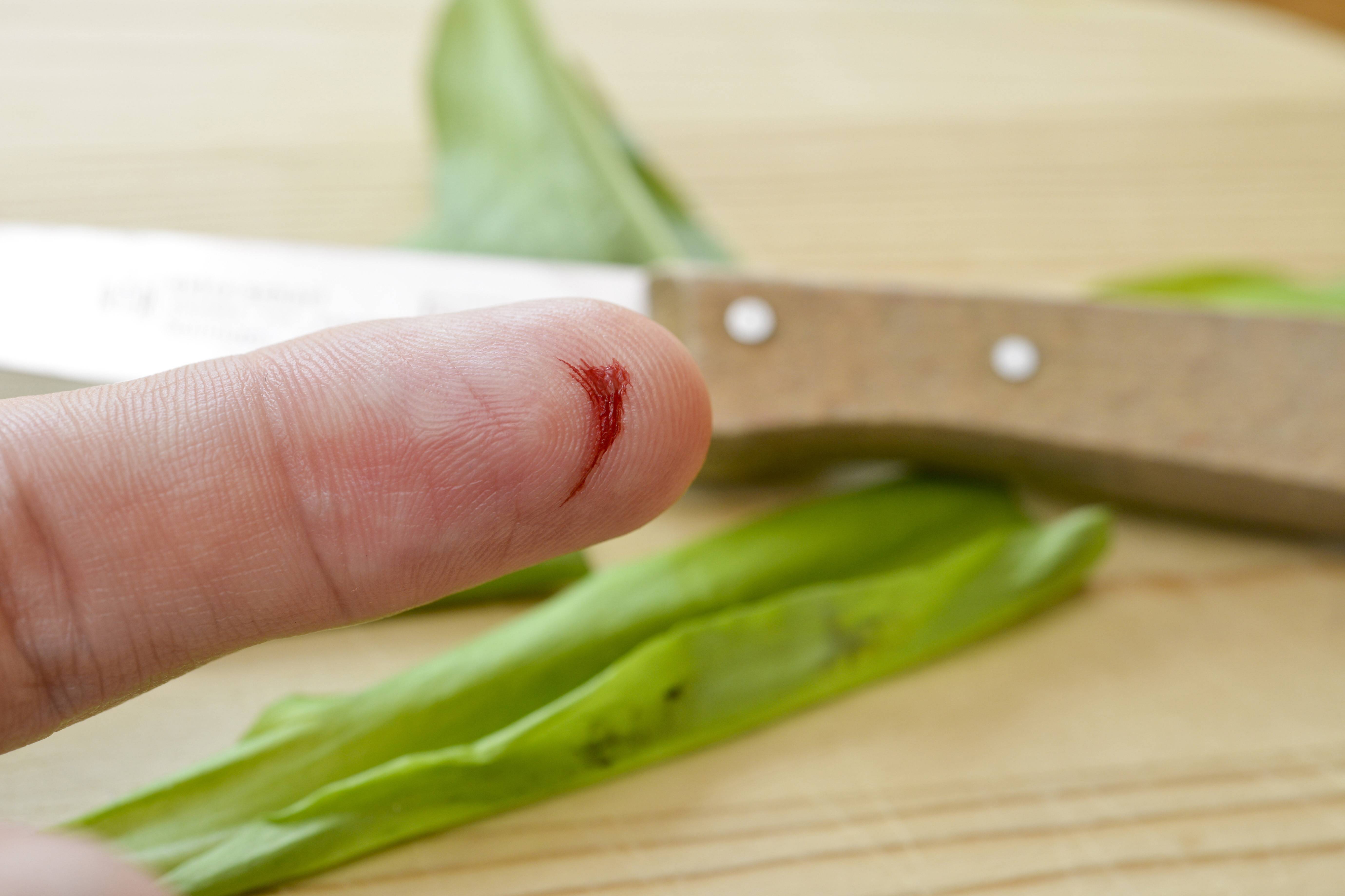 Ein Zeigefinger mit einer kleinen blutenden Scnittwunde. Im Hintergrund sieht man auf einem Holzbrett ein Küchenmesser und Gemüse.